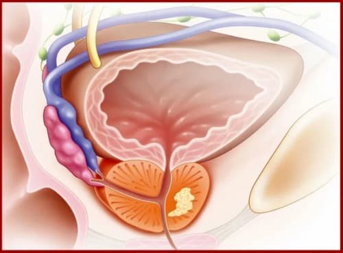 Prostinal ผลข้างเคียง